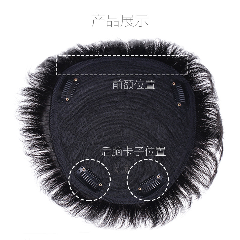 Men's hair replacement piece wig cover head hair replacement forehead bald hair replacement pad hair extension flip wig real hair men's hair block