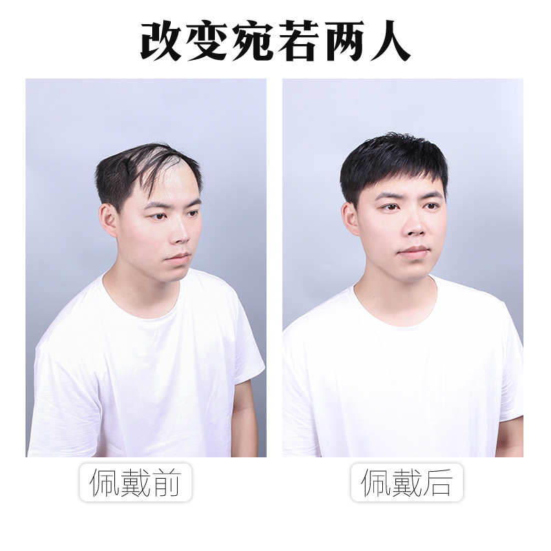 Men's hair replacement piece wig cover head hair replacement forehead bald hair replacement pad hair extension flip wig real hair men's hair block