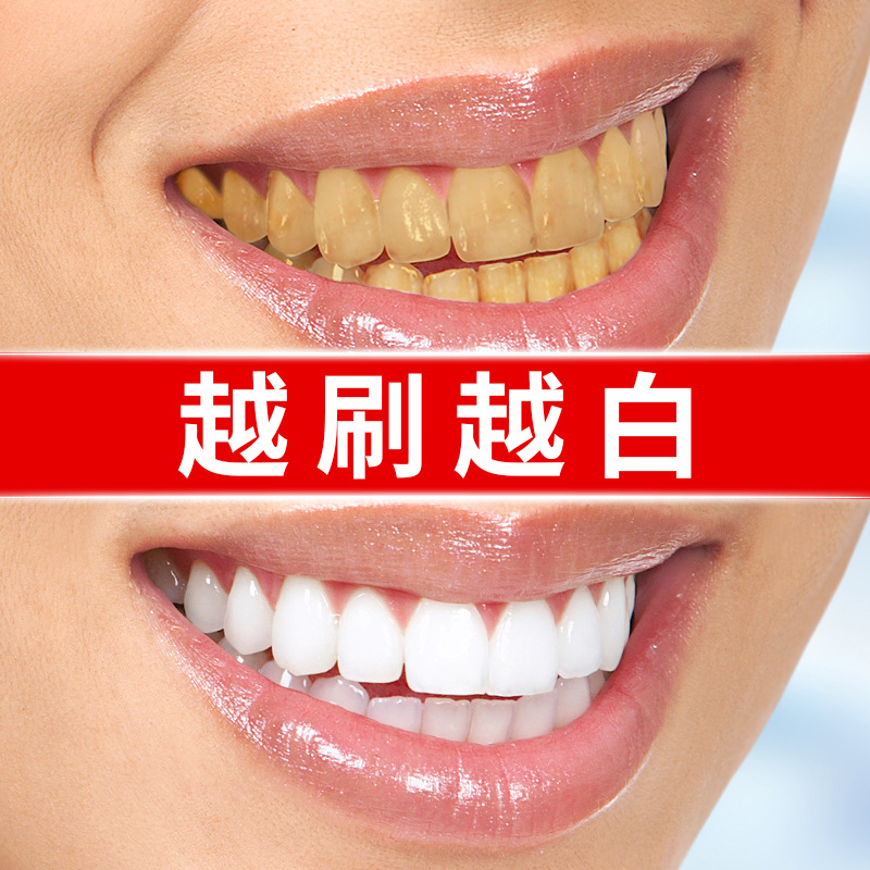 Teeth whitening pen teeth care remove yellow teeth smoke teeth remove tea stains fast teeth cleansing teeth brightening pen
