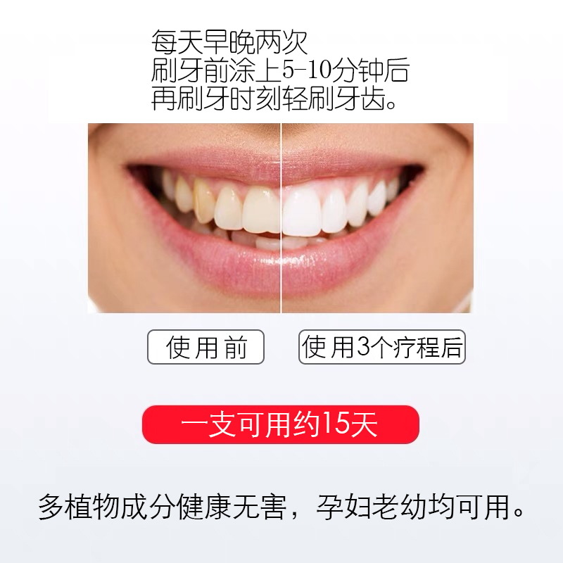 Teeth whitening pen teeth care remove yellow teeth smoke teeth remove tea stains fast teeth cleansing teeth brightening pen