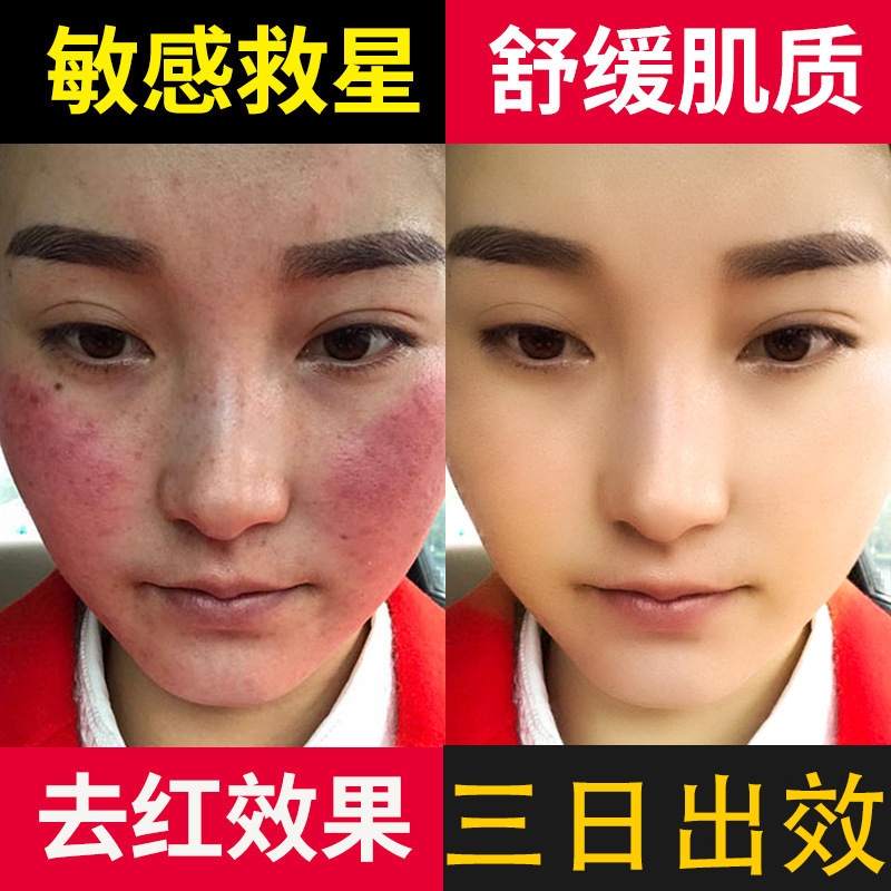 Решение для восстановления с солодкой, удаляющее покраснение, улучшающее чувствительность кожи