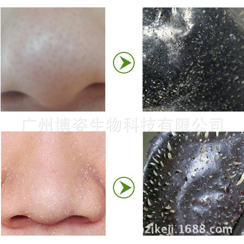 Direct selling blackhead removing nose sticker pig nose sticker tearing blackhead removing acne removing nose sticker bamboo charcoal blackhead suction nose sticker