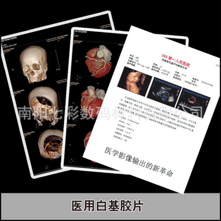 A4 medical porcelain white B ultrasound electronic gastrointestinal mirror white ink jet 150MB printing film