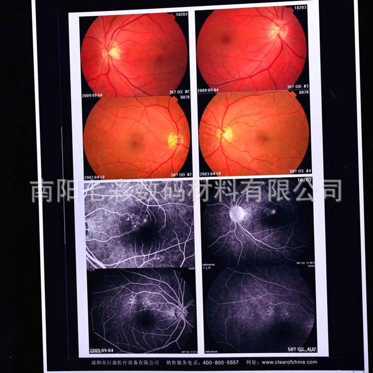 A4 medical White inkjet 150um printing film medical image color Doppler ultrasound Gastrointestinal Endoscope tear-proof film Paper