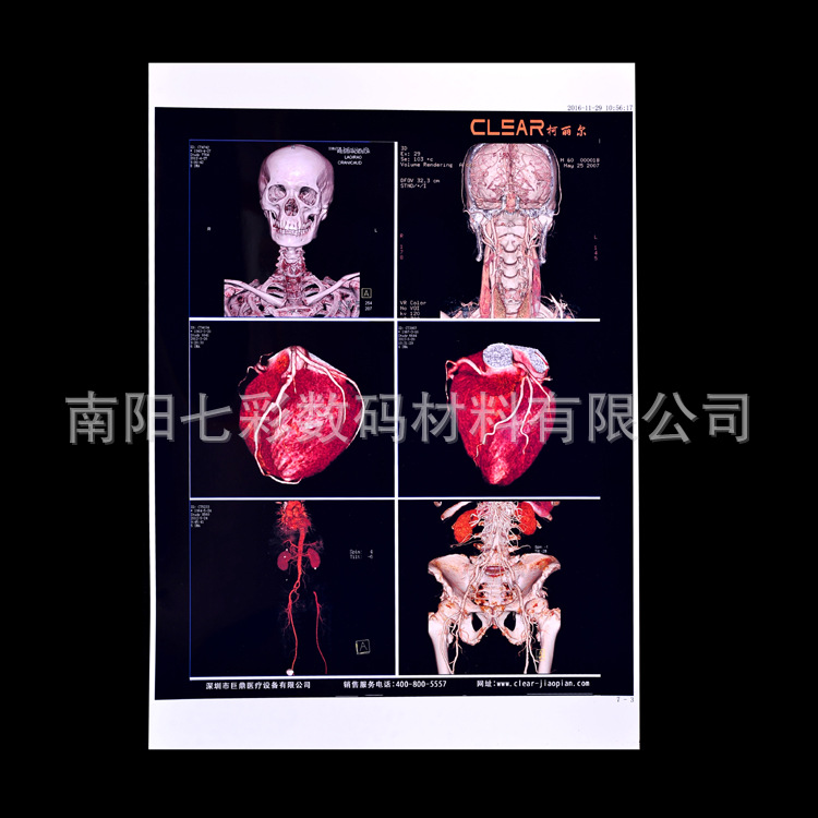 A4 medical White inkjet 150um printing film medical image color Doppler ultrasound Gastrointestinal Endoscope tear-proof film Paper