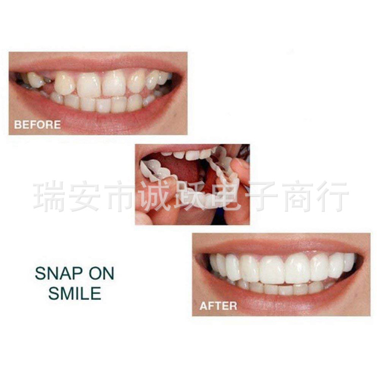 Simulation braces upper teeth lower teeth 2023 bottled particles hole-free simulation braces whitening denture cover manufacturer