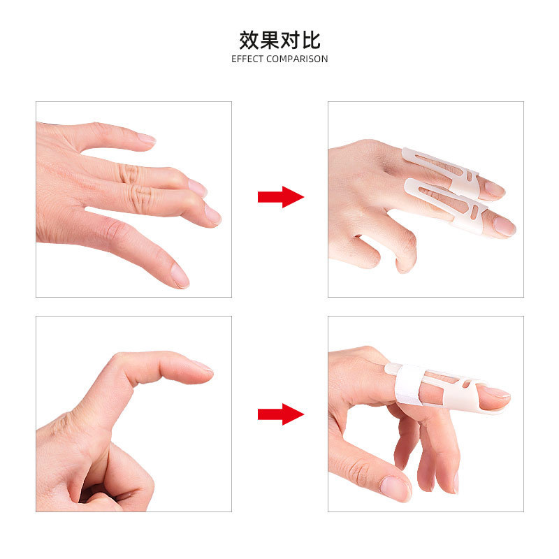 Finger Fracture Fixation Splint Finger Guard Fixed Hammer Finger Sports Neck Ring Bracelet Ring Wholesale Adjustable