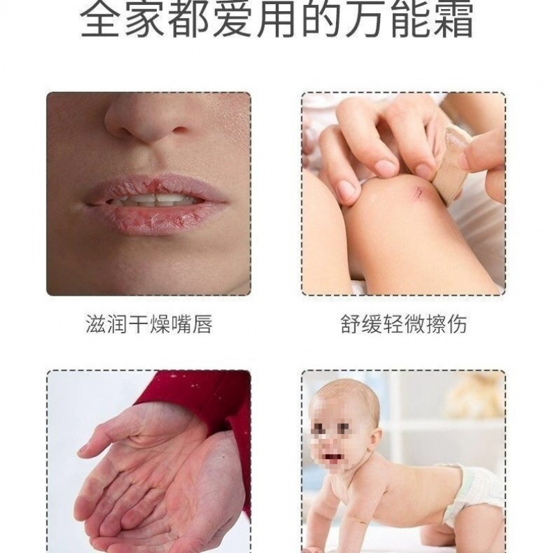 Lanolin Cream, Nipple Chapped Cream, Newborn Breastfeeding Cream, Breast Pain, Breastfeeding Pain, Pregnant Women's Skin Care, Chapped Repair Lanolin