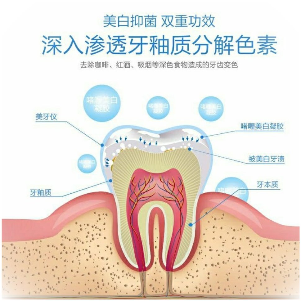 American tooth instrument gel accessories micro-business with blue light whitening smoke stains yellow black teeth Bifuti light free verse Loga