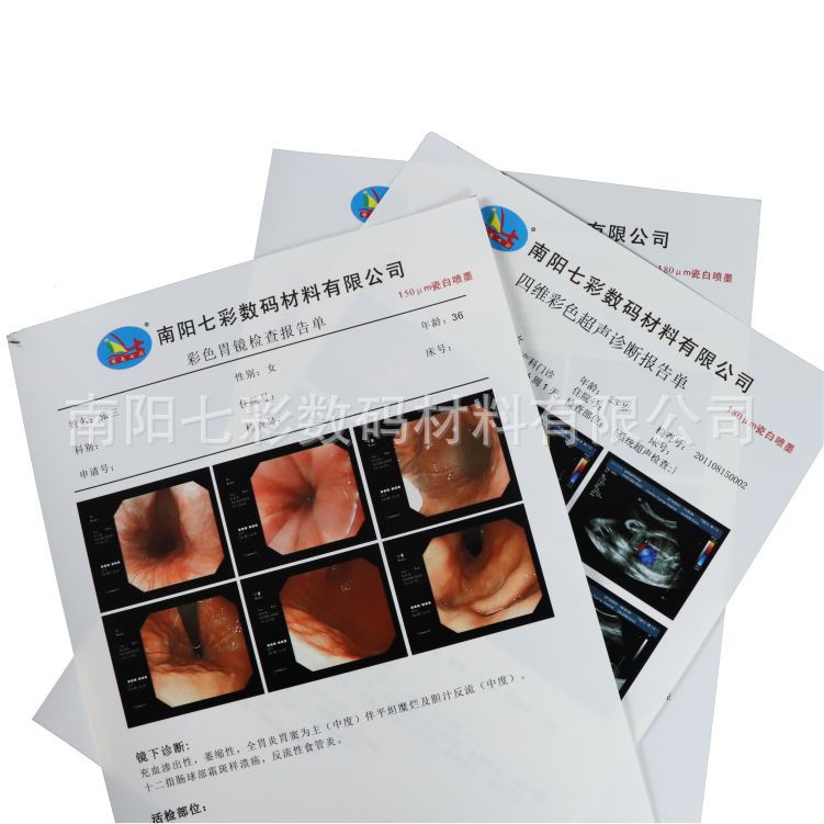 A4 medical White inkjet 150um printing film medical image color Doppler ultrasound Gastrointestinal Endoscope tear-proof film Paper