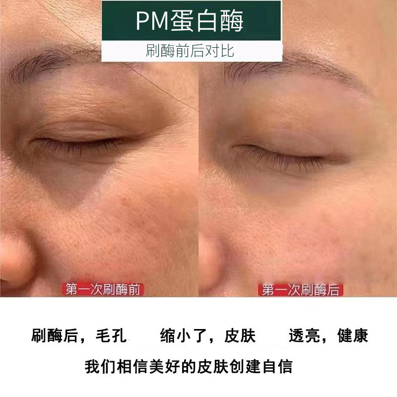 Beauty Salon Special for Brush Enzyme Activity PM Protease Beauty Brush Enzyme Lift Firming Rejuvenating Biological Enzyme Therapy Kit