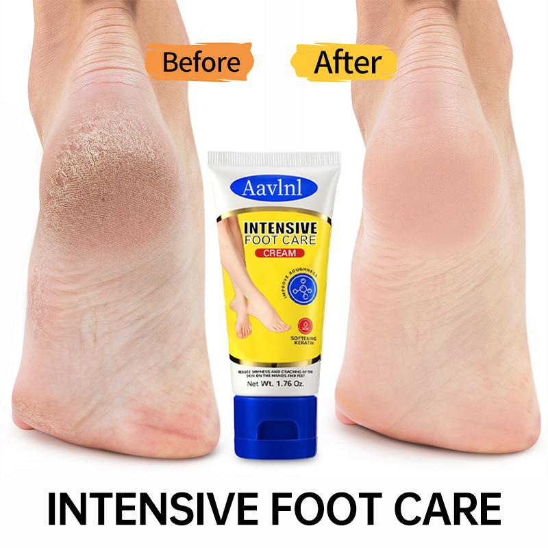 Spot Straight Hair Aavlni Foot Care Cream Repairs Cracks, Softenes Calluses, Moisturizes Foot Lotion