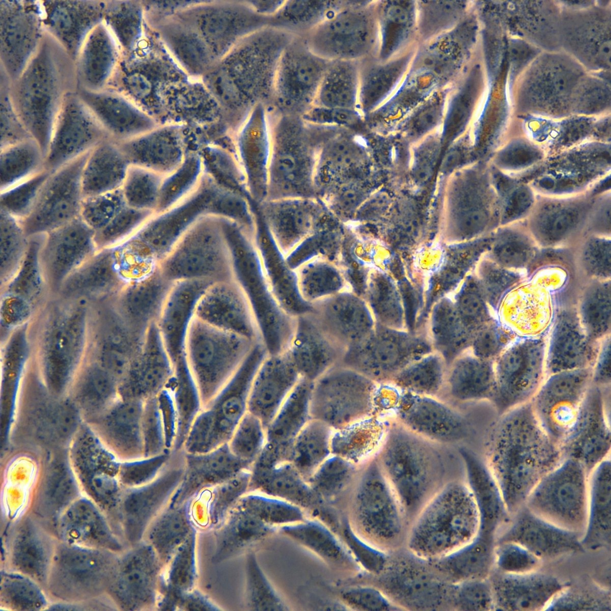 Meisen Ctcc Meisen Human Low-Differentiated Lung Adenocarcinoma Cells Sk-Lu-1