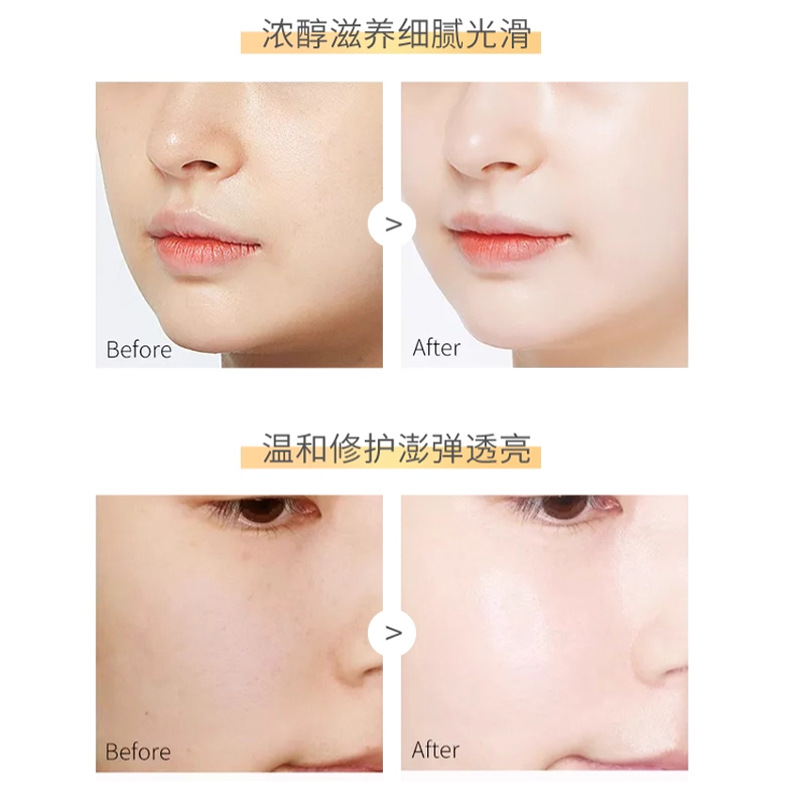 [100 Capsules] Fullerene Sheep Placenta Essence Smear-On Facial Essence Oil Chicken Leg Second-Pulse Soft Capsules