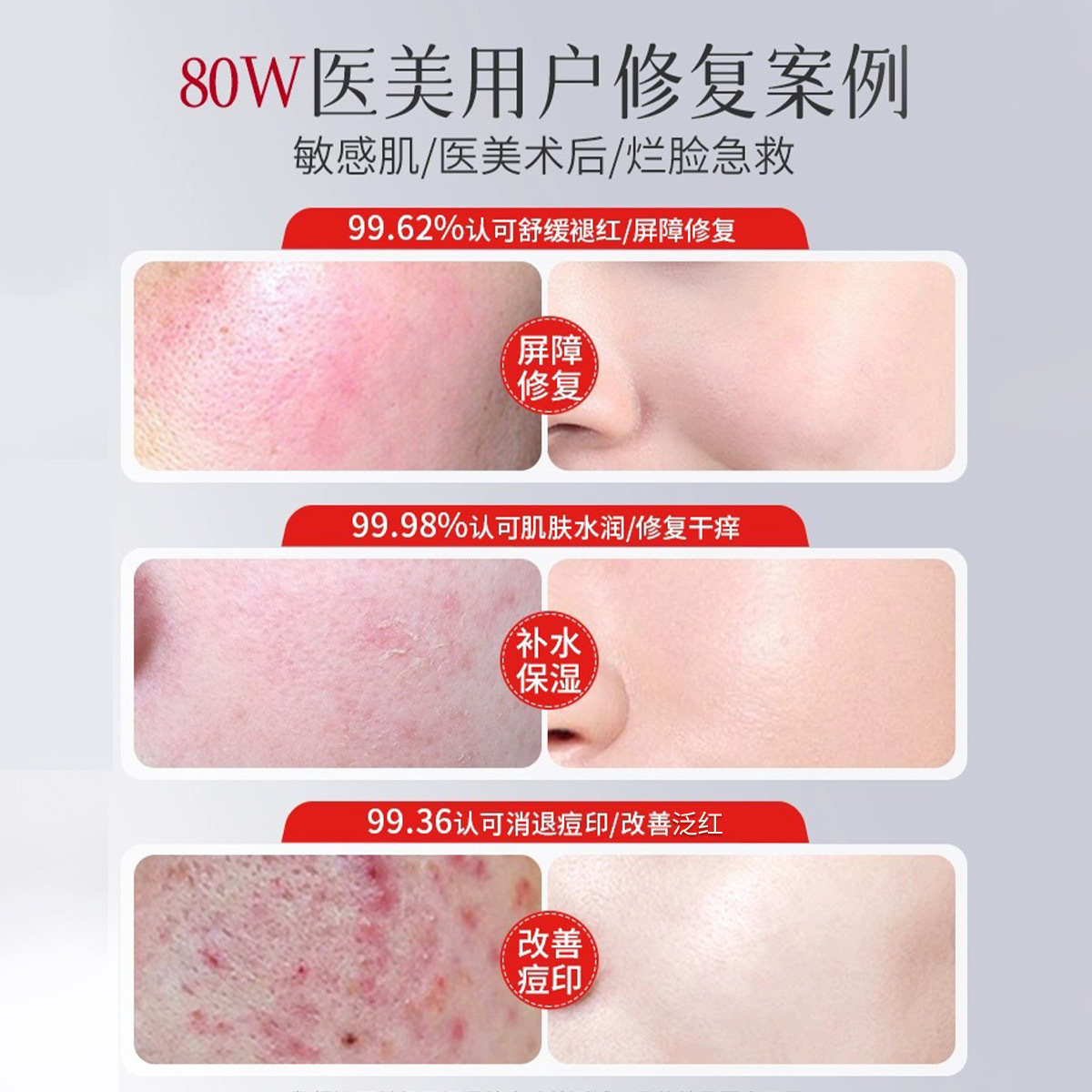 Medical-Grade Sterile Soothing Toner for Sensitive Skin, Post-Treatment Repair and Hydration, Non-Spray Type