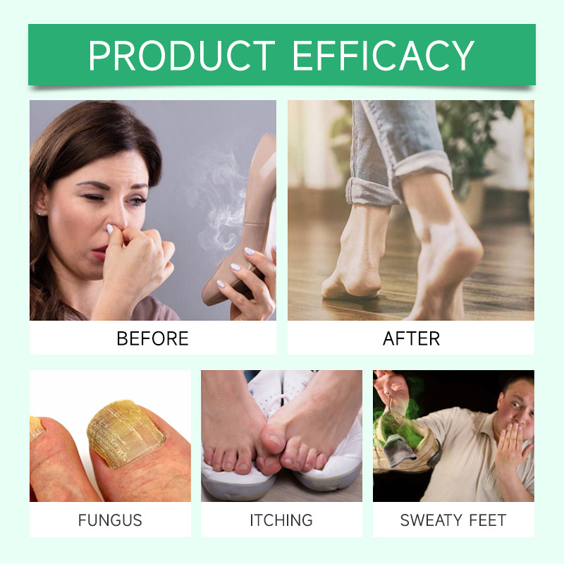 Cross-Border Foot Care Spray, Foot and Heel Moisturizing, Nourishing, Deodorizing and Odor-Removing Care Agent Spray