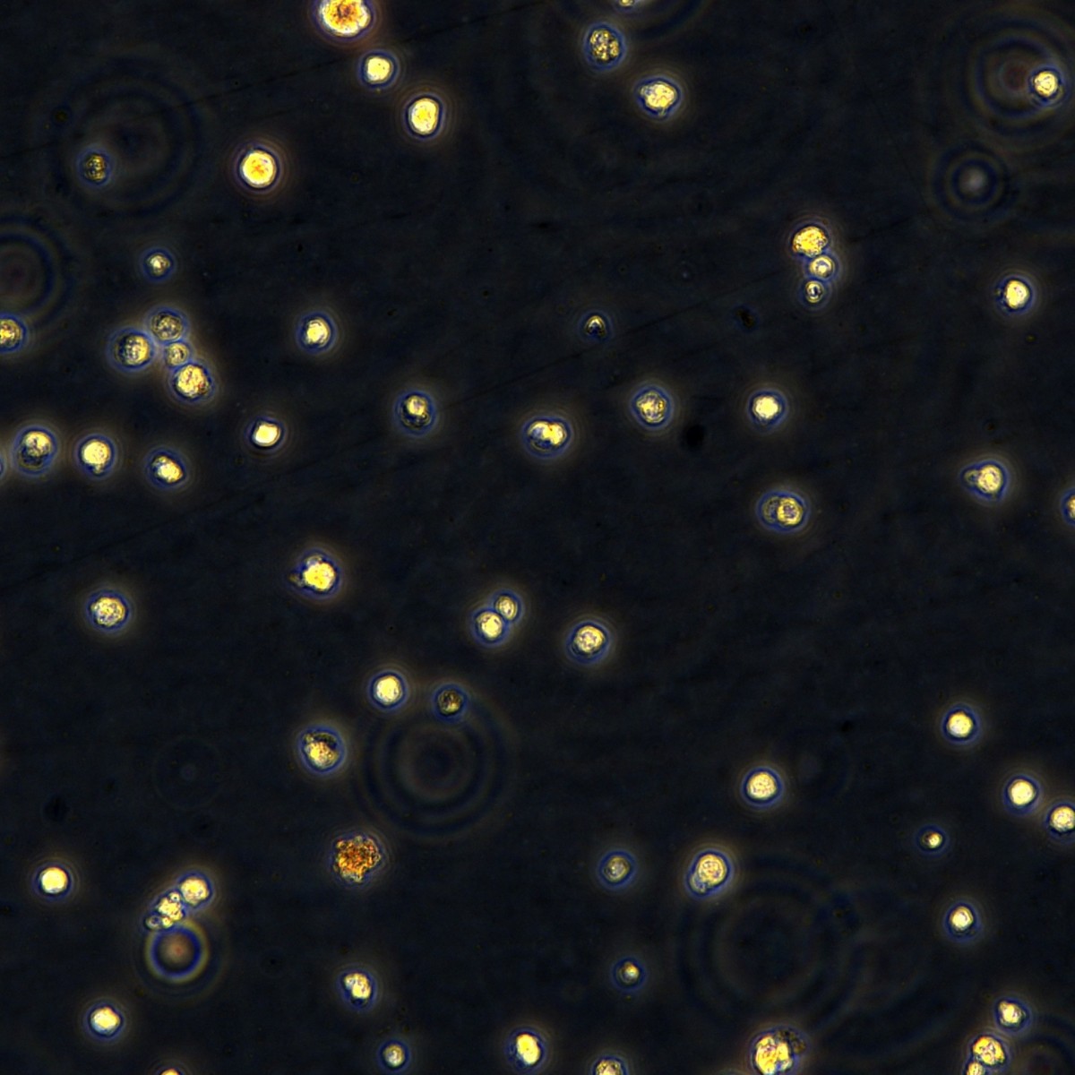 Meisen Ctcc Chronic Myeloid Leukemia/Illness Imatinib Resistant Strain K562/Imatinib