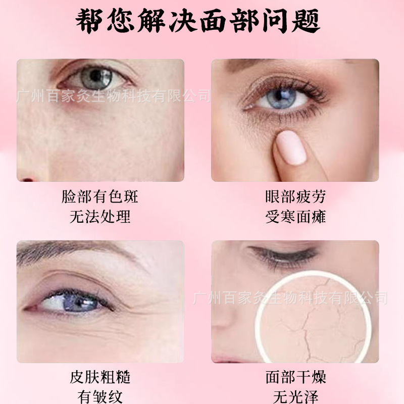 Peach Blossom Moxibustion Facial Care Brightening Skin Color Beauty Salon Special Essential Oil Scraping Moxibustion Pot Beauty Moxibustion Set