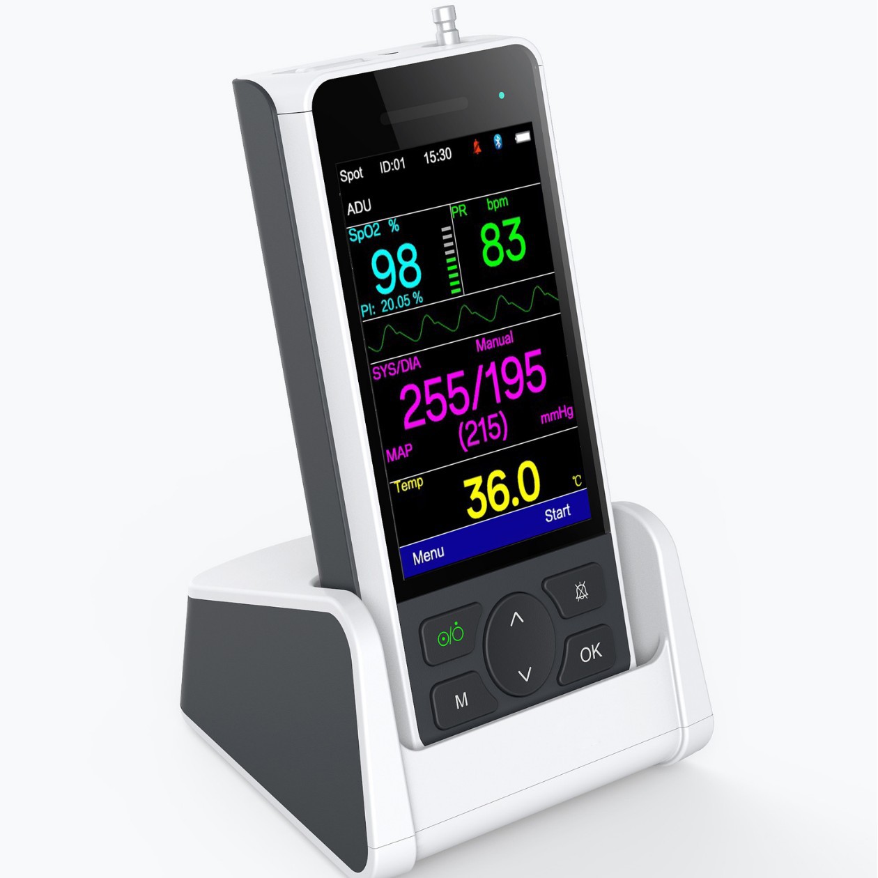 Вашуиен Rnpet 100 Ветеринарный трехпараметрический монитор животных, монитор для кошек и собак, обновленный портативный монитор