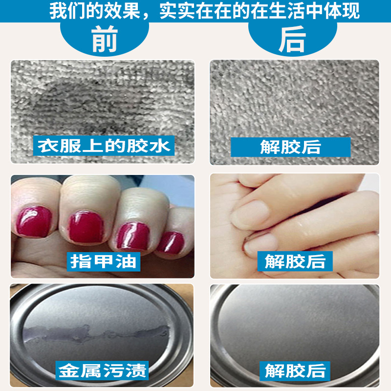 502 Degumming Agent Acetone Cleaning Agent Instant Glue Stain Cleaning Agent Dissolving Agent Remover Nail Art 101 401 Degumming Agent