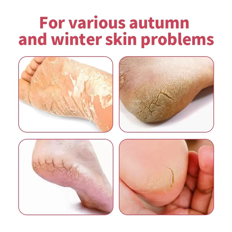 Cross-Border Hot-Selling Heel Stick, Foreign Trade Heel Dry and Cracked Foot Care Stick, Hydrating, Moisturizing, Anti-Chapped Care Stick