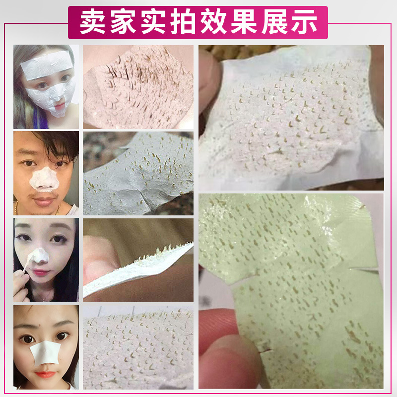 General trade Thailand blackhead removing nose patch Garysoon white aloe vera gel unisex pig nose patch
