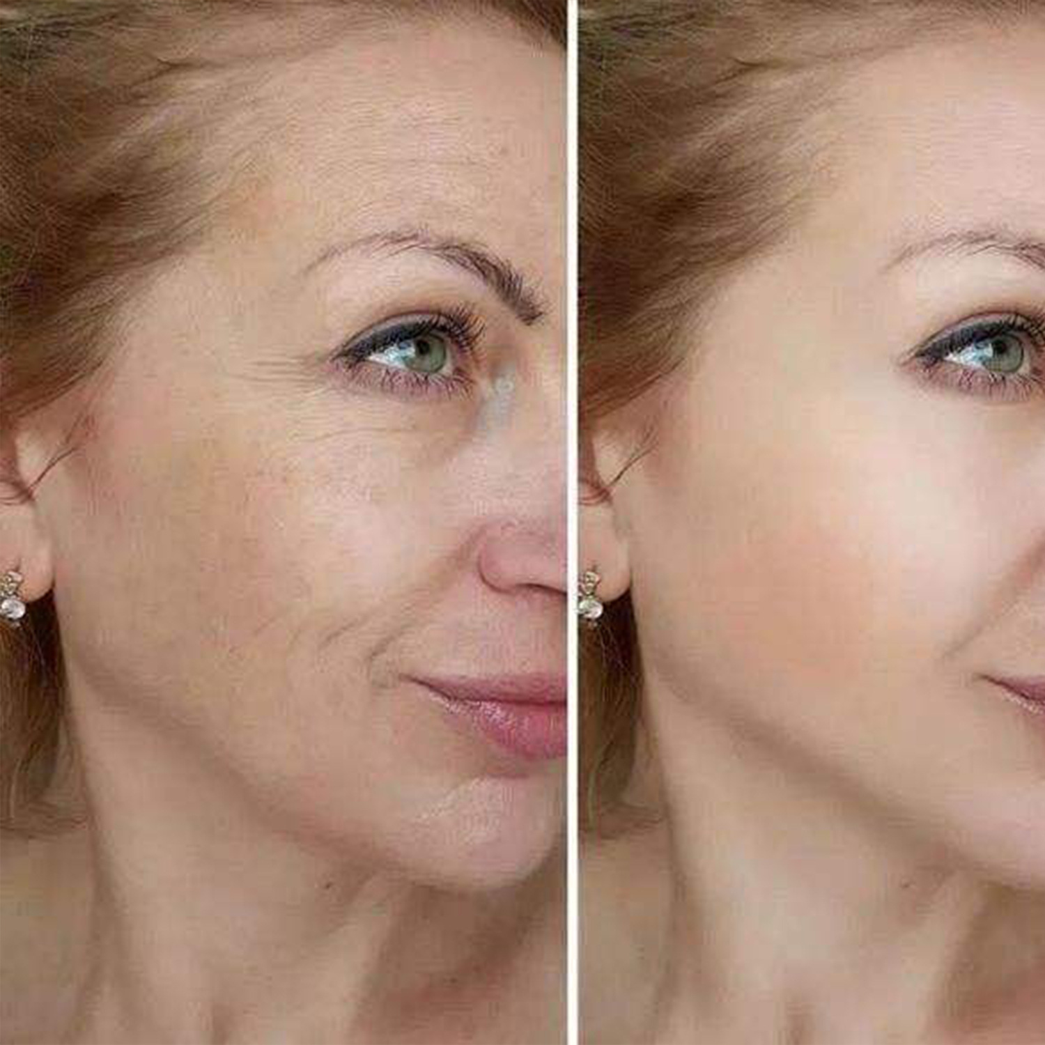Amazon Cross-Border Eye Cream Stick Improves Dark Circles and Lifts the Skin
