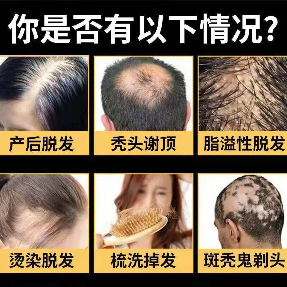 Herbal anti-hair loss hair growth liquid hair growth dense hair tough hair root hairline growth liquid hair growth liquid hair growth liquid