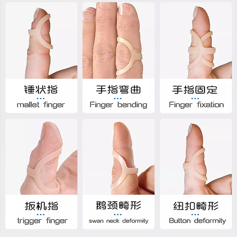 Finger Correction Sheath Plastic Adjustable Finger Joint Injured Bending Fixation Finger Correction Fixation