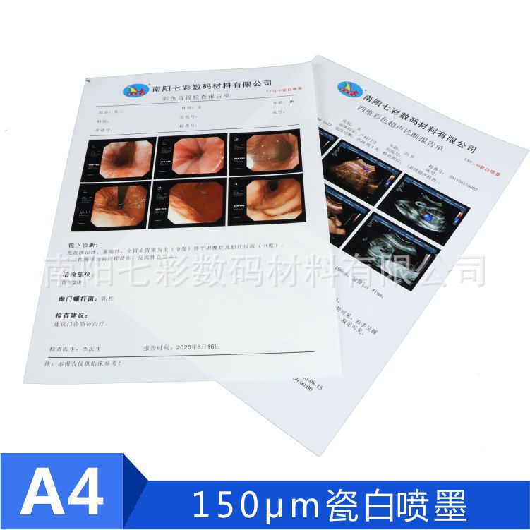 A4 медицинская фарфоровая белая B ультразвуковая электронная гастроинтестинальная зеркальная белая струйная 150MB печатная пленка