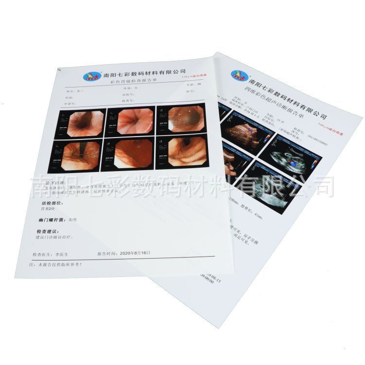 A4 medical White inkjet 150um printing film medical image color Doppler ultrasound Gastrointestinal Endoscope tear-proof film Paper