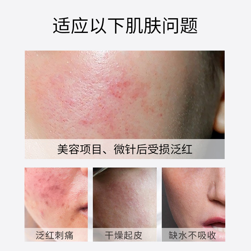 Redness-Reducing Gel Sponge Microneedle Spot-Dissolving Solution, Soothing and Repairing Gel for Post-Sun Redness, Original Solution for Repairing and Reducing Redness, Hyaluronic Acid