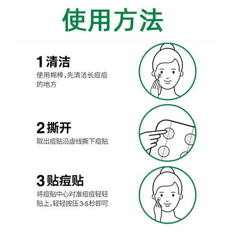 Tiger VT Pox Patch Same as CICA Anti-suction Pupulitis First Aid Acne Removal Invisible Patch for Acne Students Affordable genuine goods