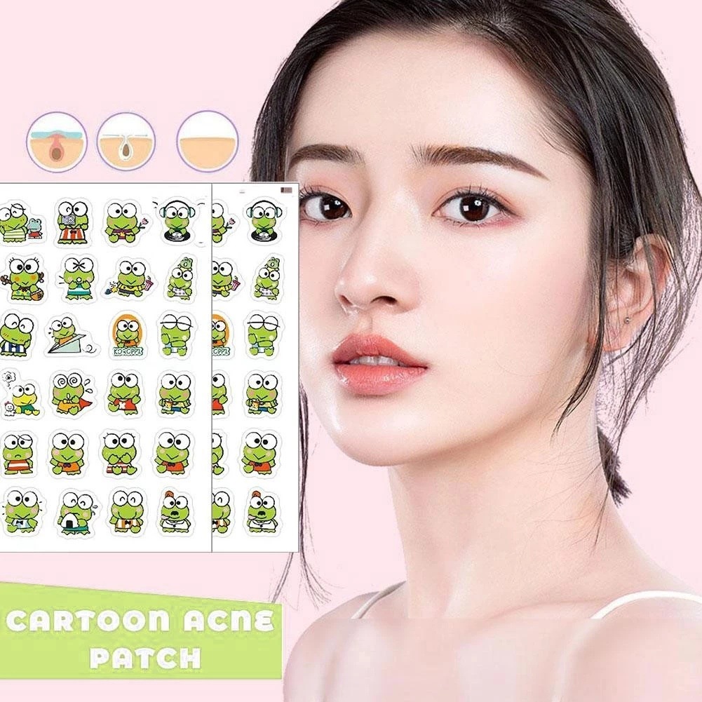 Cross-Border Shopee Colorful Acne Patch Pe Cartoon Acne Sticker Cover Concealer Gentle Spot Manufacturer Wholesale