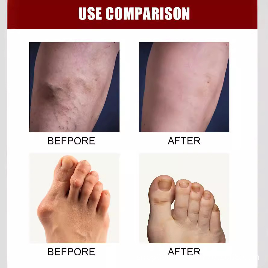 Joint Bone Collagen Cream Soothes Joint Bone Pain, Deformation Correction and Repair 30g Box