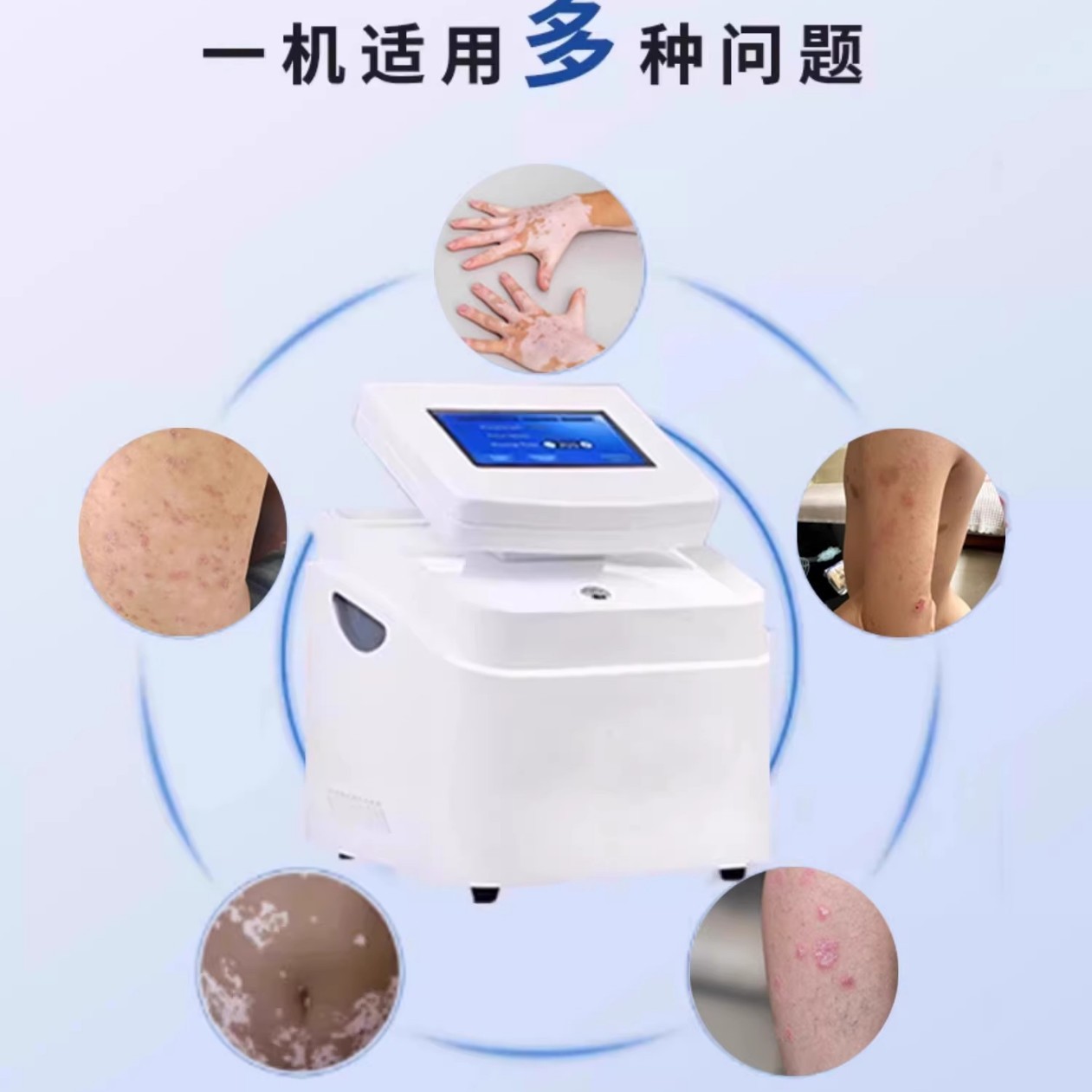 Vitiligo 308Nm Treatment Instrument Phototherapy Excimer Household Laser Ultraviolet Medical Physiotherapy Instrument Psoriasis 311