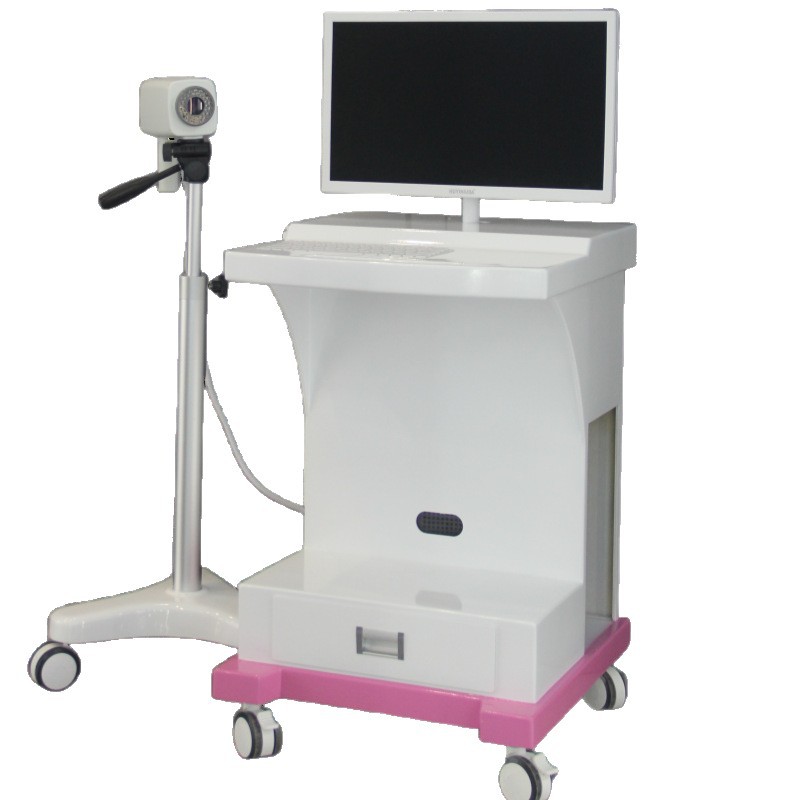 Xuzhou Xinma Manufacturer Electronic Colposcope Manufacturer 6000 Private Gynecological Examination Instrument 019 Installation Fee