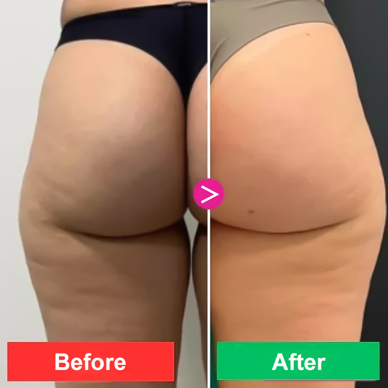 Cross-Border Popular Customized Multi-Kinetic Body Cream to Strengthen Abdominal Muscles, Firm Skin, Moisturize, Refresh and Non-Greasy Oem