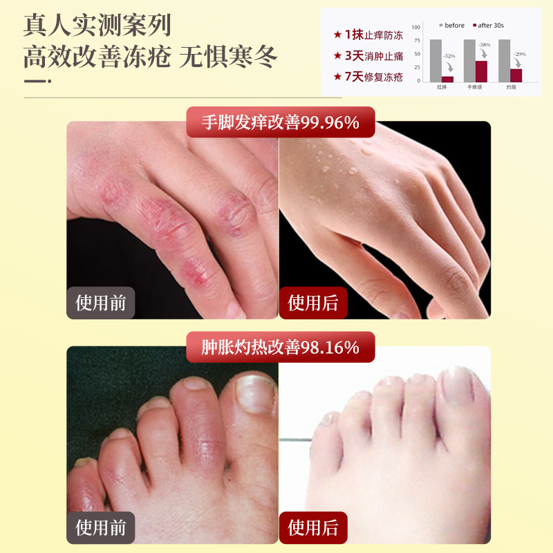 Sunflower Skin Care Ointment for Acne, Dermatitis, Eczema, Sensitive Skin, Redness, Soothing Care Ointment, Repair Ointment