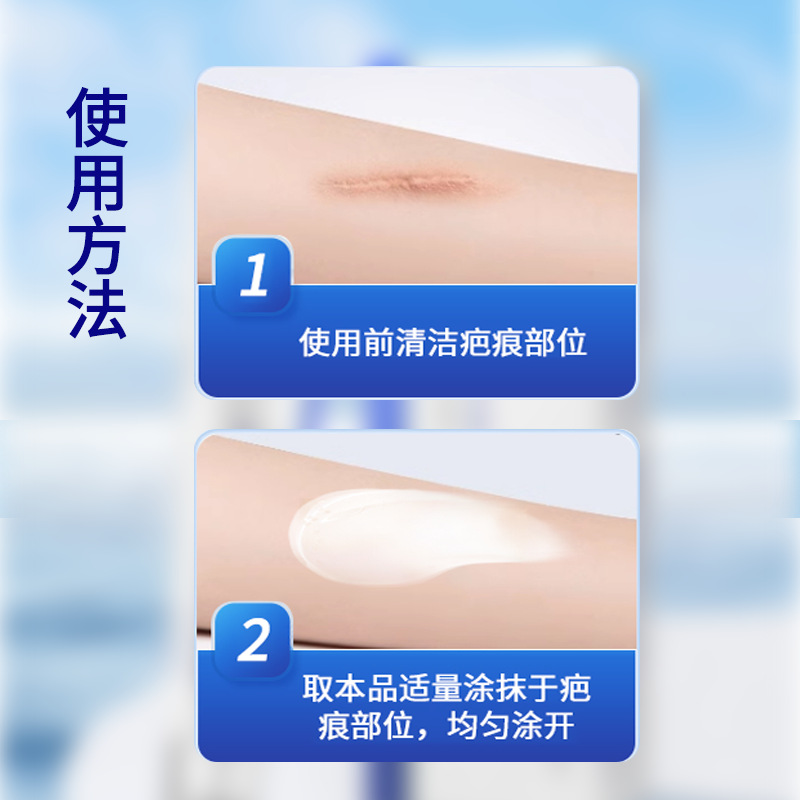 Light Scars, Scalds, Caesarean Section Scars, Skin Moisturizing, Repairing Dry Cracked Scores, Wound Scars, Gel, Genuine Wholesale