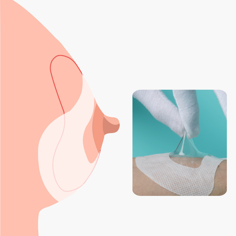 Фиксированная наклейка для защиты сосков, вспомогательная наклейка для молочного щита, вспомогательная наклейка для кормления, 30 штук