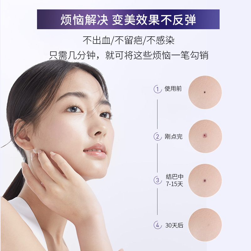 Dot Pen Household Dot Pen White Laser Spot Pen Wart Point Beauty Instrument Painless Spot Pen Beauty and Spot Removing Instrument