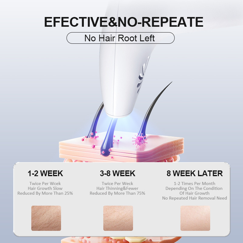 Handheld Laser Hair Removal Device Home Ipl Hair Removal Instrument Ice Feeling Whole Body Strong Pulse Hair Removal Machine