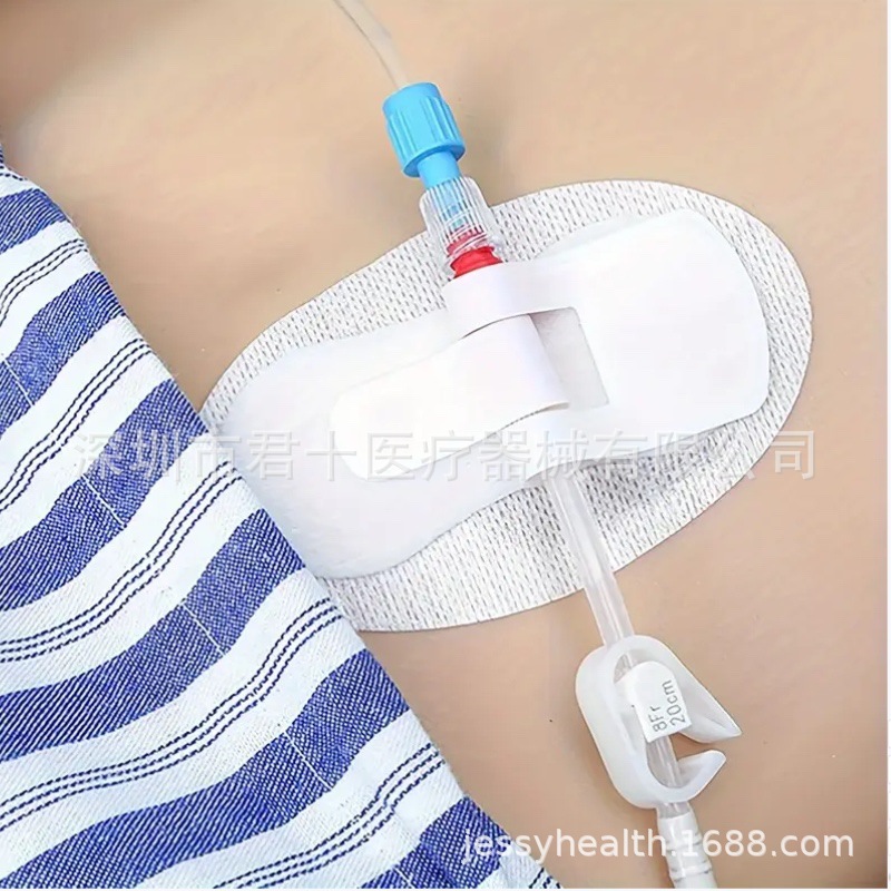 Picc Superficial Catheter Fixation Patch Urinary Catheter Fixation Catheter Patch Infusion Fixation Tube Patch Fixation Patch Tracheal Intubation