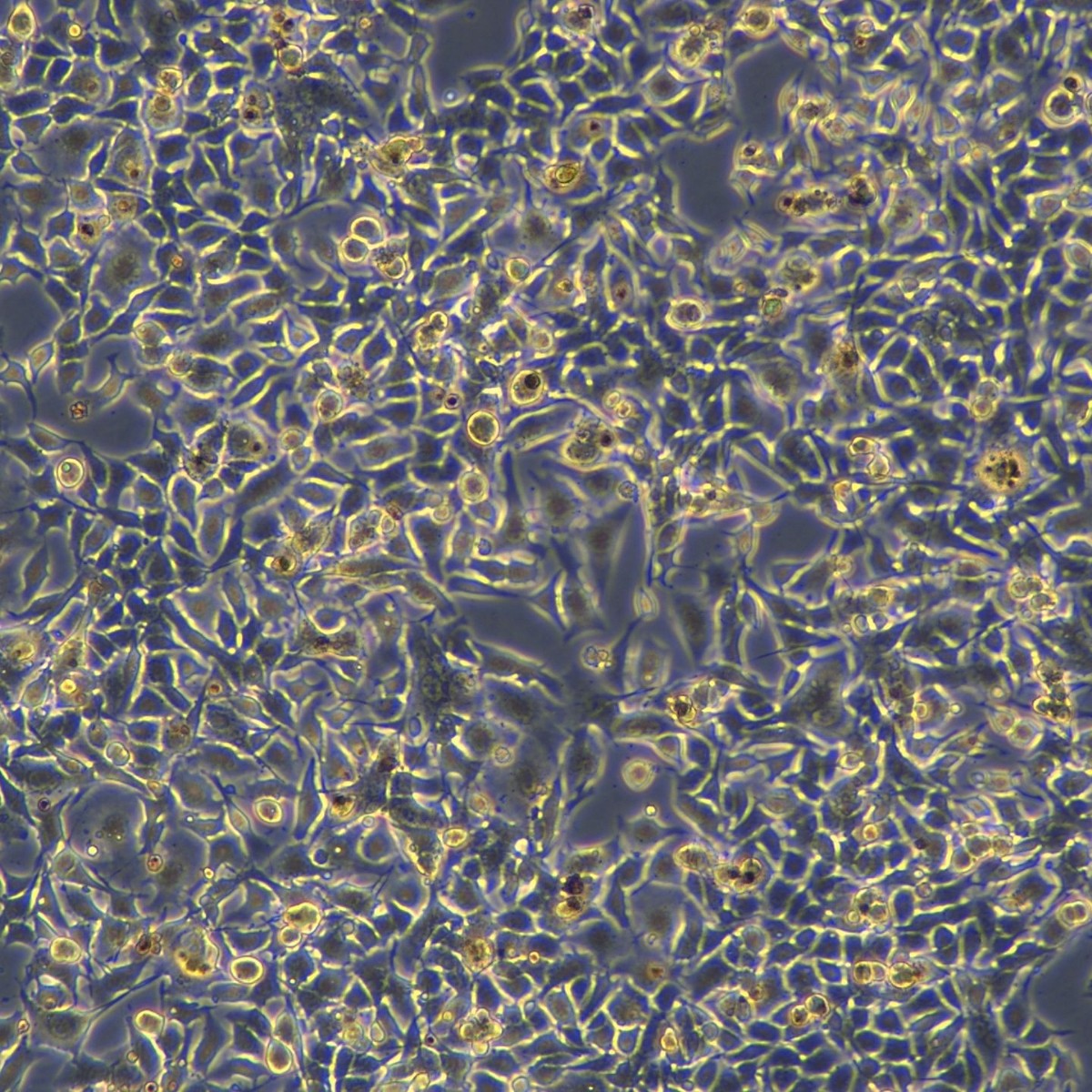 Meisenctcc Mouse Melanoma Cells B16F10-Ova