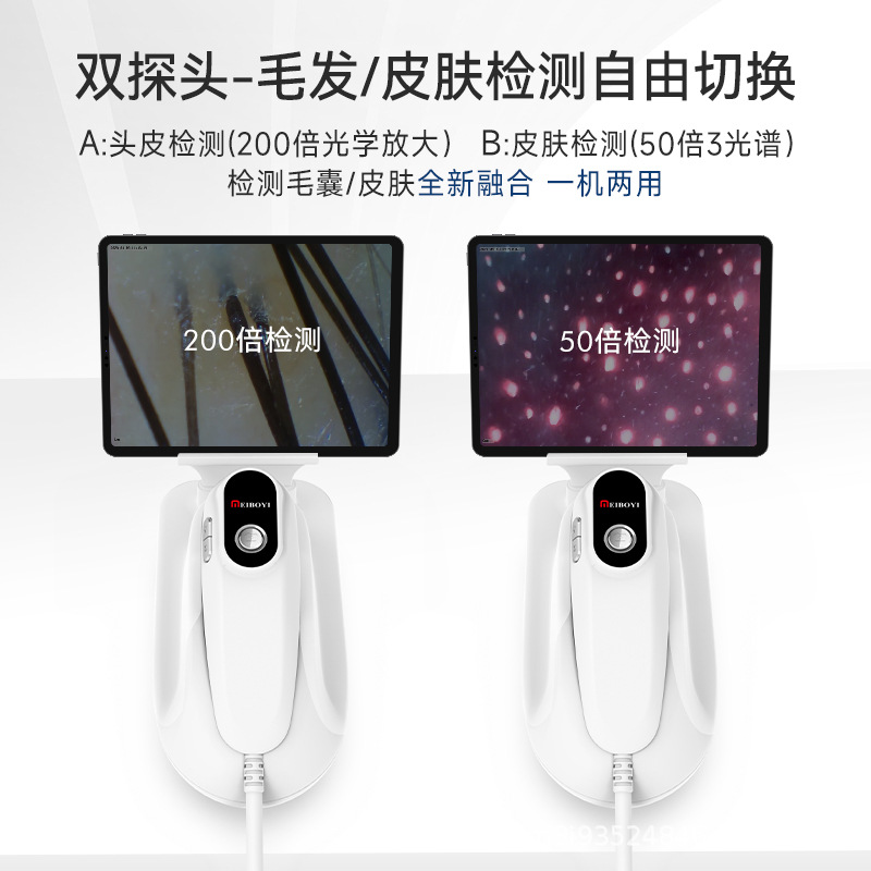 Three spectrum scalp skin detector USB connected to mobile phone computer tablet portable scalp skin detector