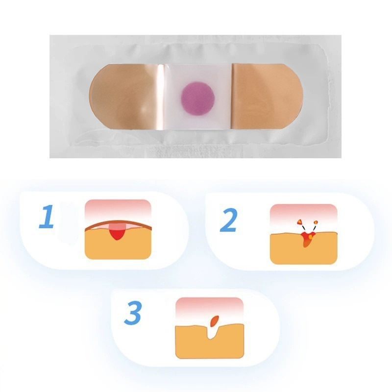 Pu Film Corn Patch, Corn Ointment, Callus Patch, Foot Callus Remover, Foot Care, Foot Relief, Jiyukang Patch, Corn Patch