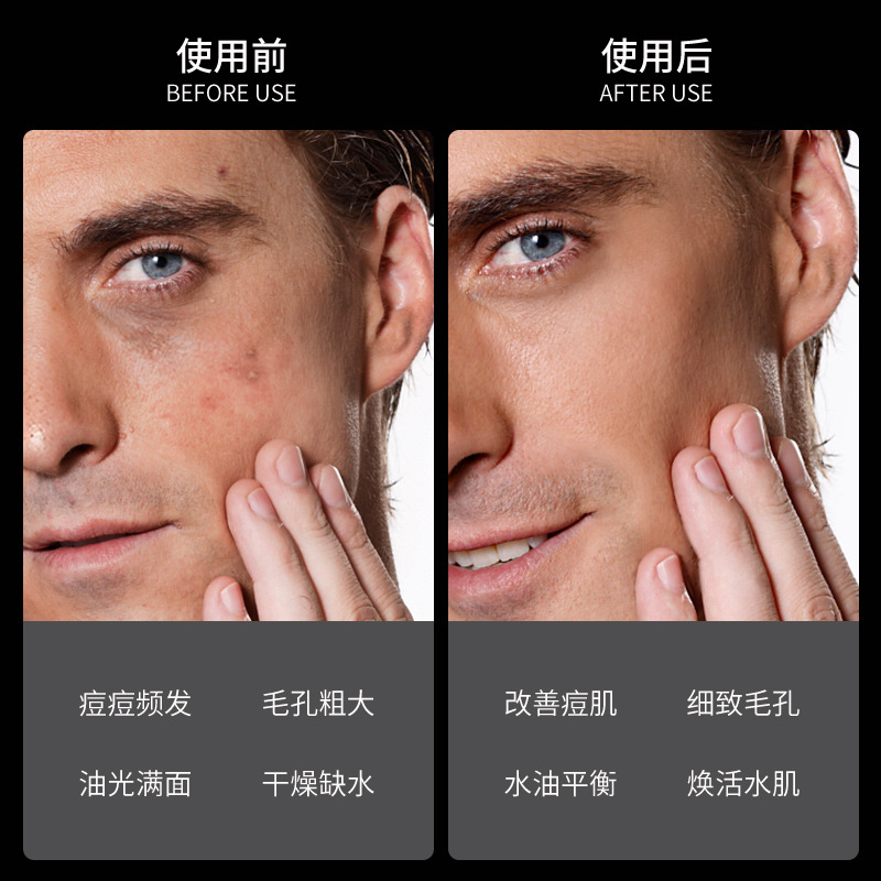 Jefquan Men's Mineral Mud Oil Control Set Cleansing Oil Control Moisturizing Refreshing Cleansing Men's Skin Care Set