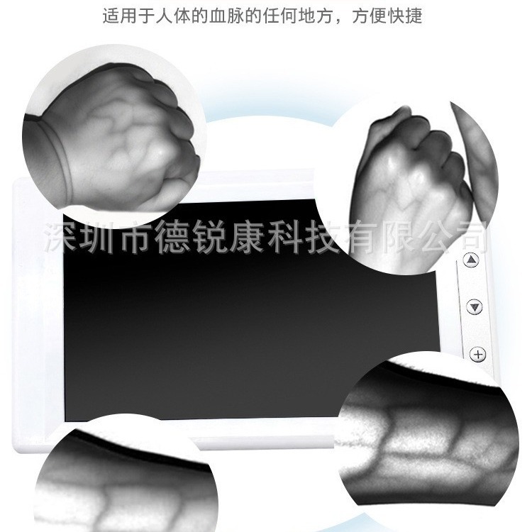 Vascular imaging instrument LCD vein detector infusion liquid crystal display nurse detection according to factory direct venipuncture