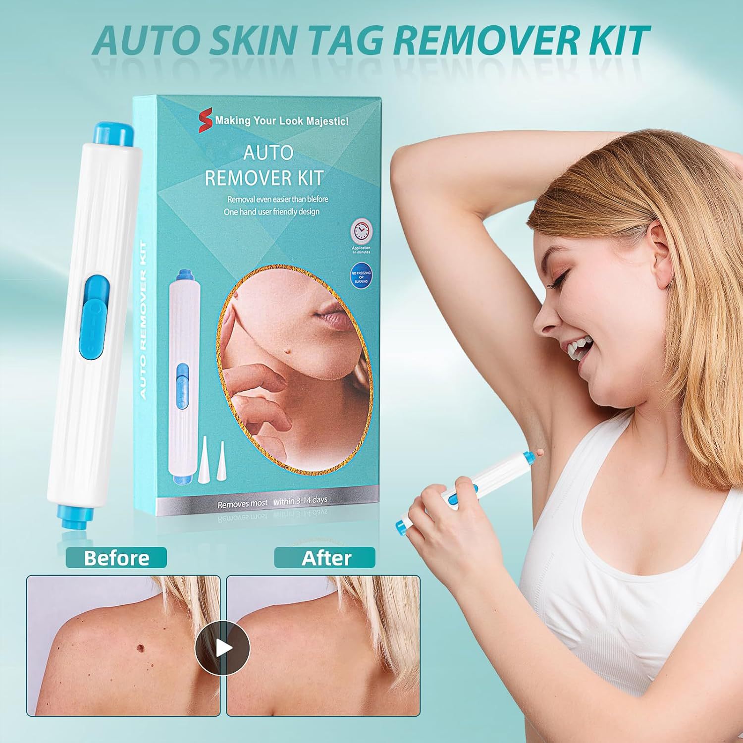 Cross-Border Skin Tag Remover for Home Use, Skin Tag and Mole Remover, Portable Skin Tag Removal Kit